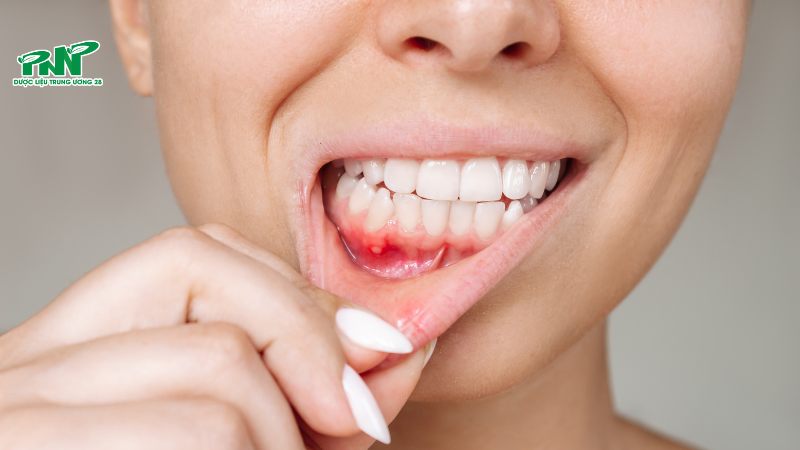 Việc duy trì chế độ ăn uống cân bằng giúp cơ thể ổn định hệ tiêu hóa và giảm nguy cơ nổi mụn hoặc nhiệt miệng.